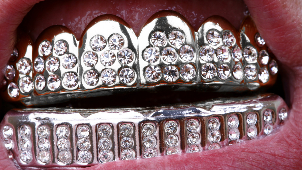 How to Save on Dentures, Dental Crowns and Bridges