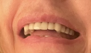mouth upper arch