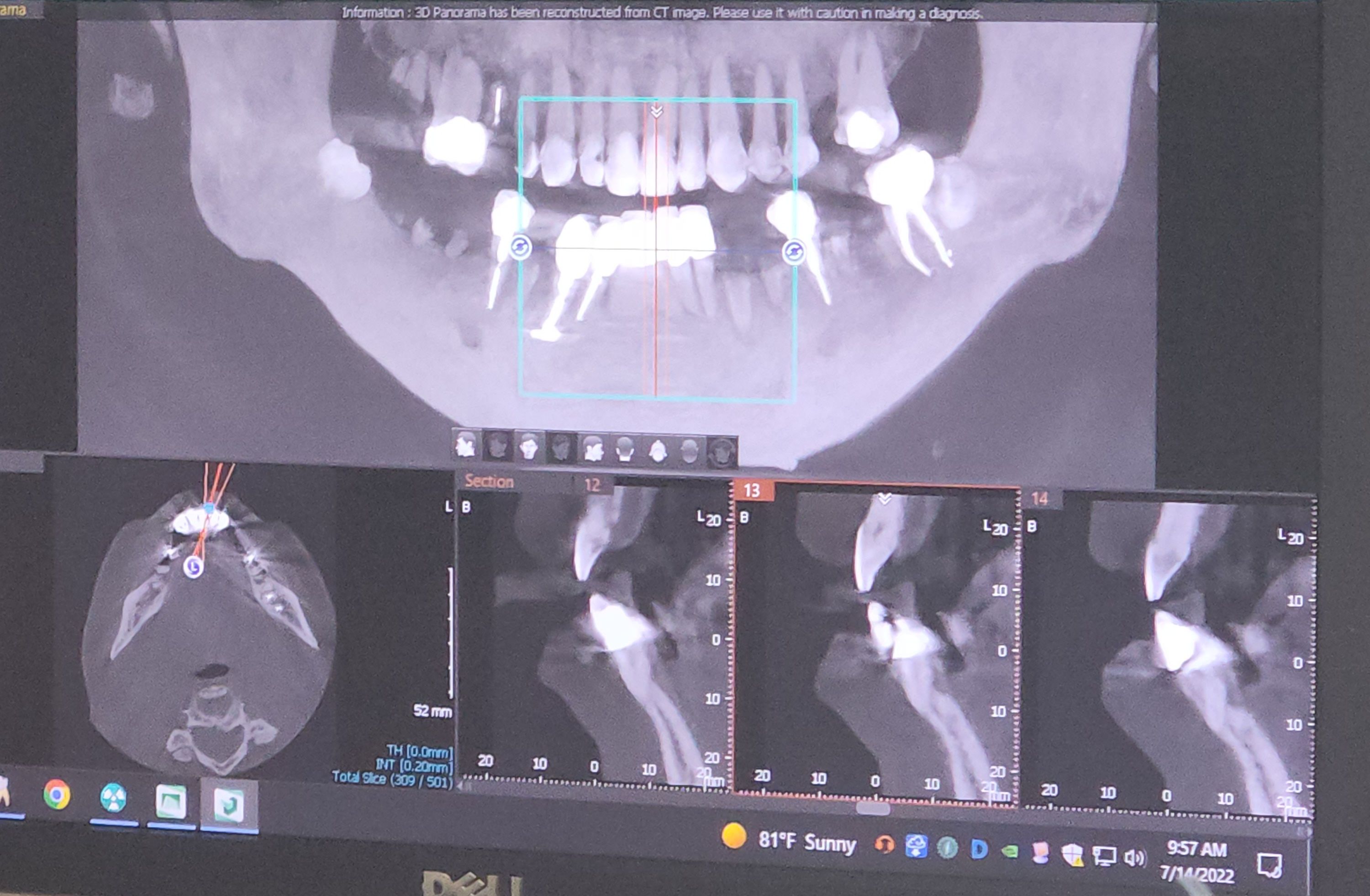 mouth closed