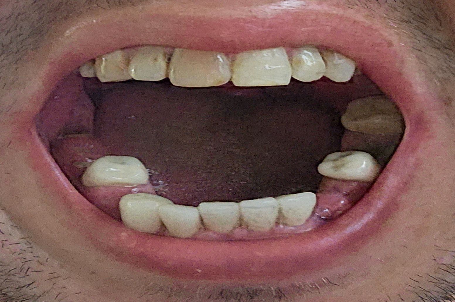 mouth lower arch