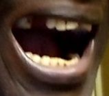 mouth closed mouth closed