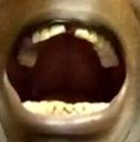 mouth open mouth open