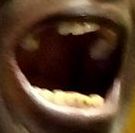 mouth left side mouth left side