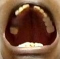 mouth upper arch