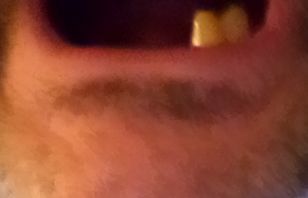mouth lower arch