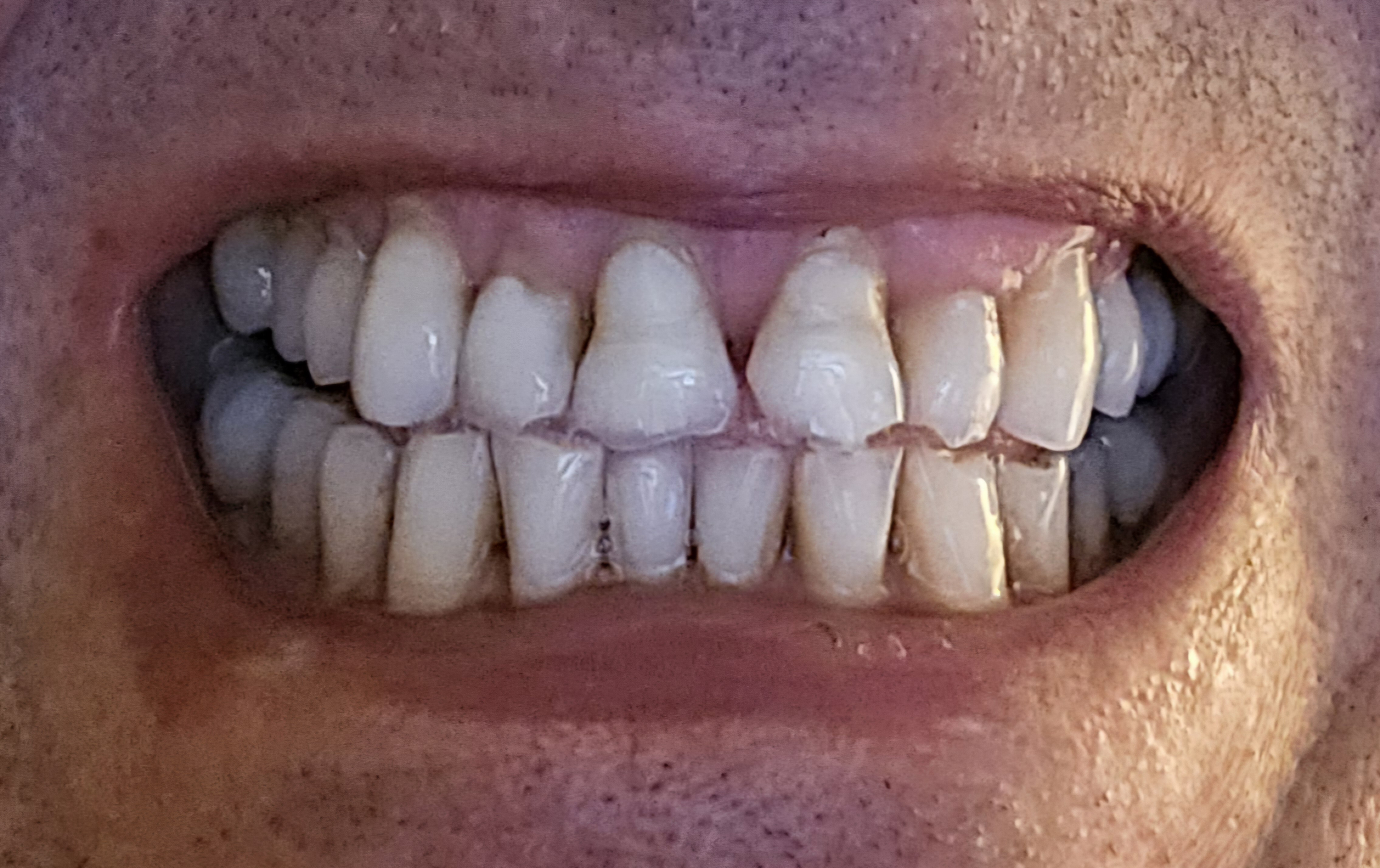 mouth closed