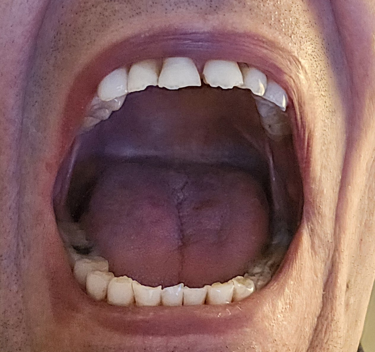mouth open