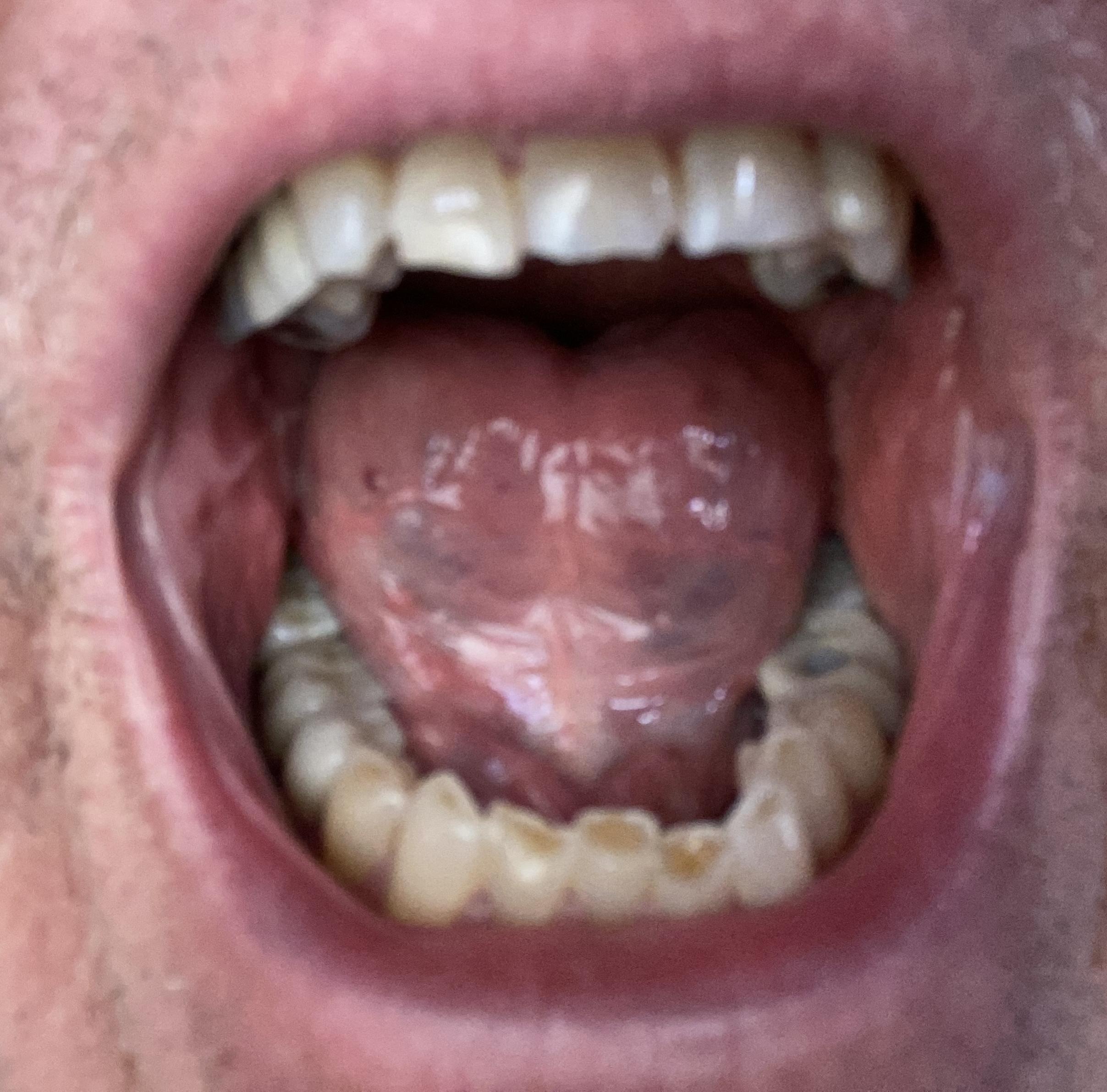 mouth open